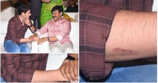 Viral Pic: A Small Scratch On Mahesh’s Hand